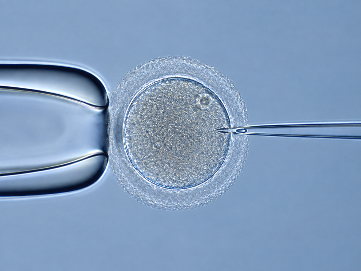 FIV — Fertilização in Vitro