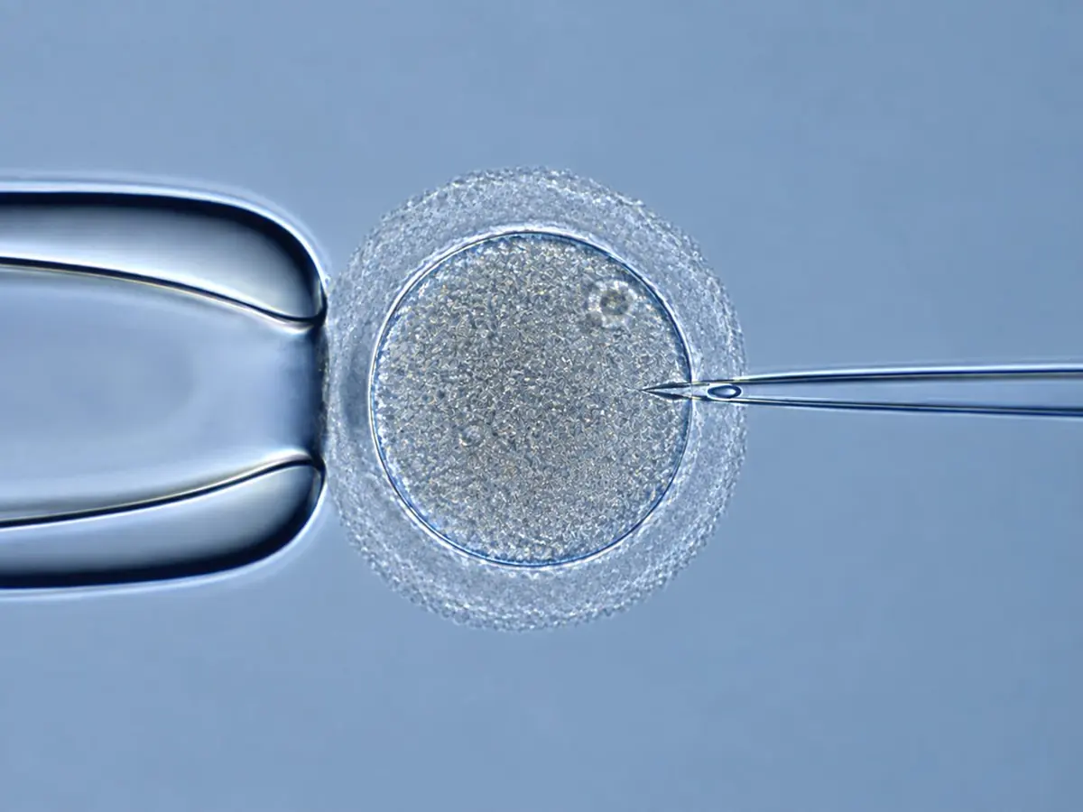 Fertilização in vitro