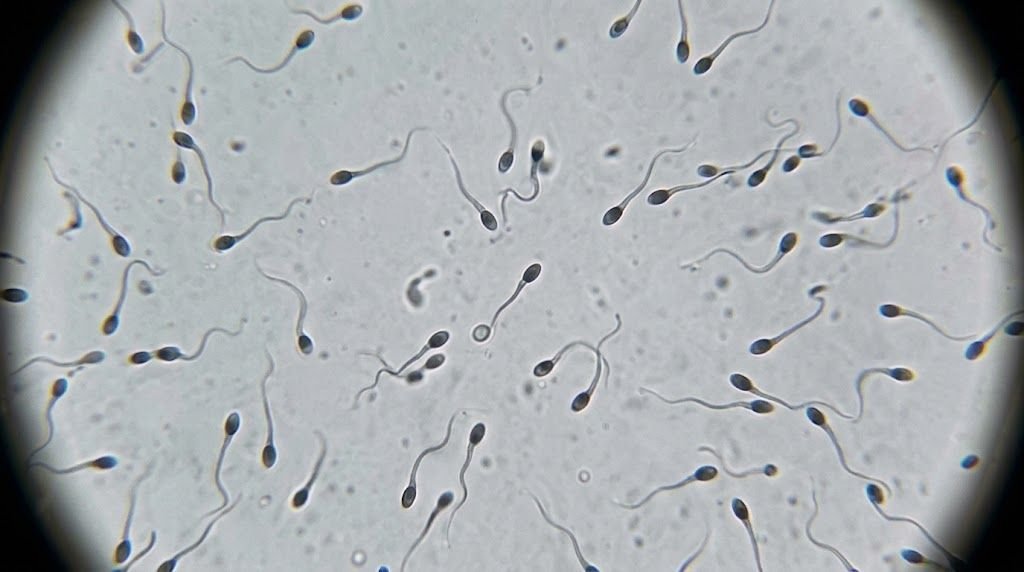 Inseminação Intrauterina